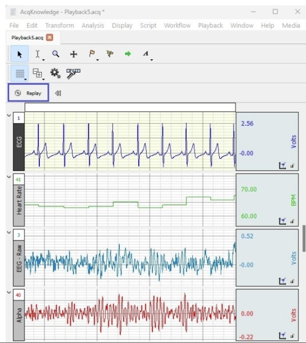 BIOPAC-AcqKnowledge 5 data acquisition and analysis software BIOPAC-AcqKnowledge 5 data acquisition and analysis software