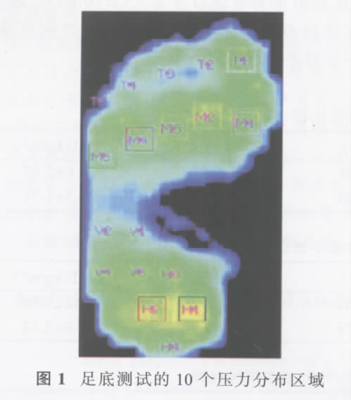 Tekscan
