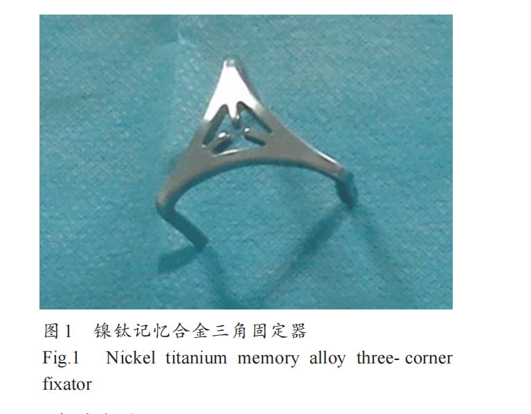 三种内固定器械固定中足损伤的生物力学比较 三种内固定器械固定中足损伤的生物力学比较
