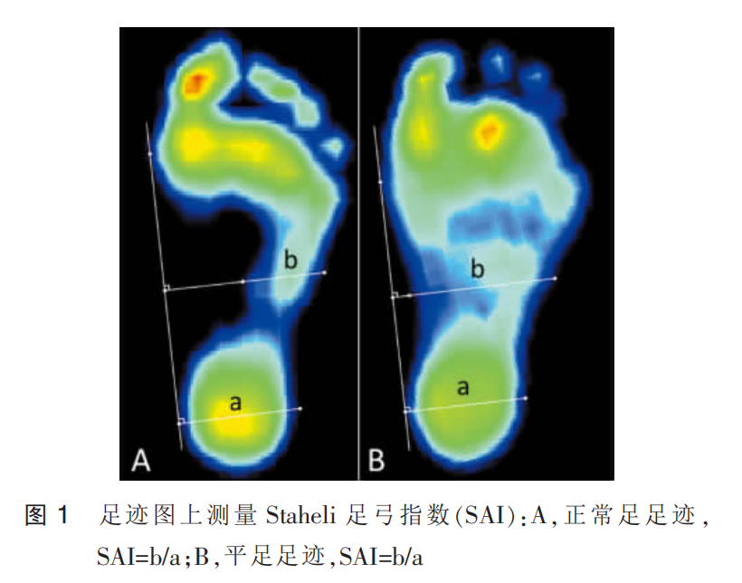 学龄期儿童柔韧性平足的横断面流行病学研究 学龄期儿童柔韧性平足的横断面流行病学研究